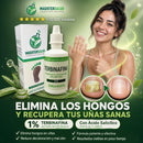 TERBINAFINA TRATAMIENTO CONTRA HONGOS ORIGINAL