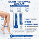 CREMA PARA VARICES
